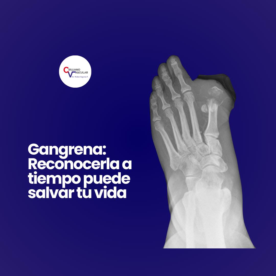 Imagen 011